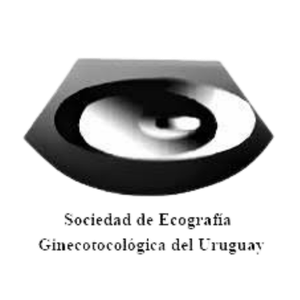 SEGU